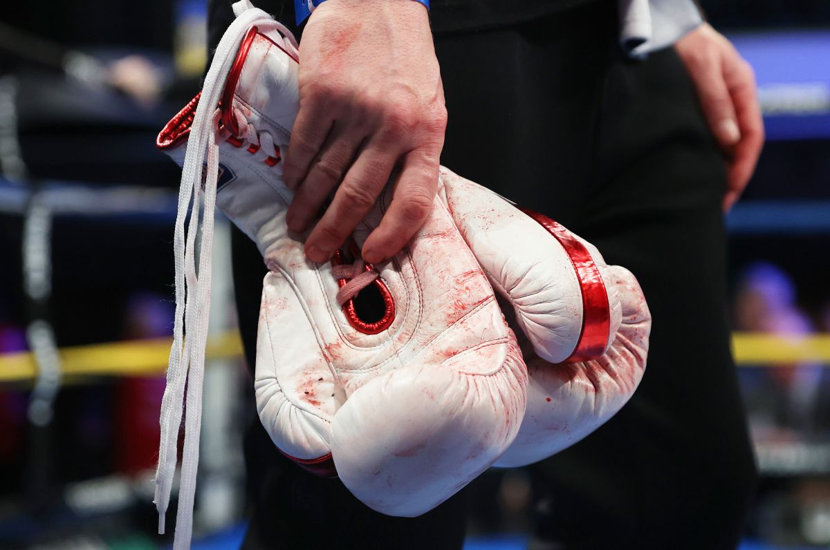 Guantes de boxeo.