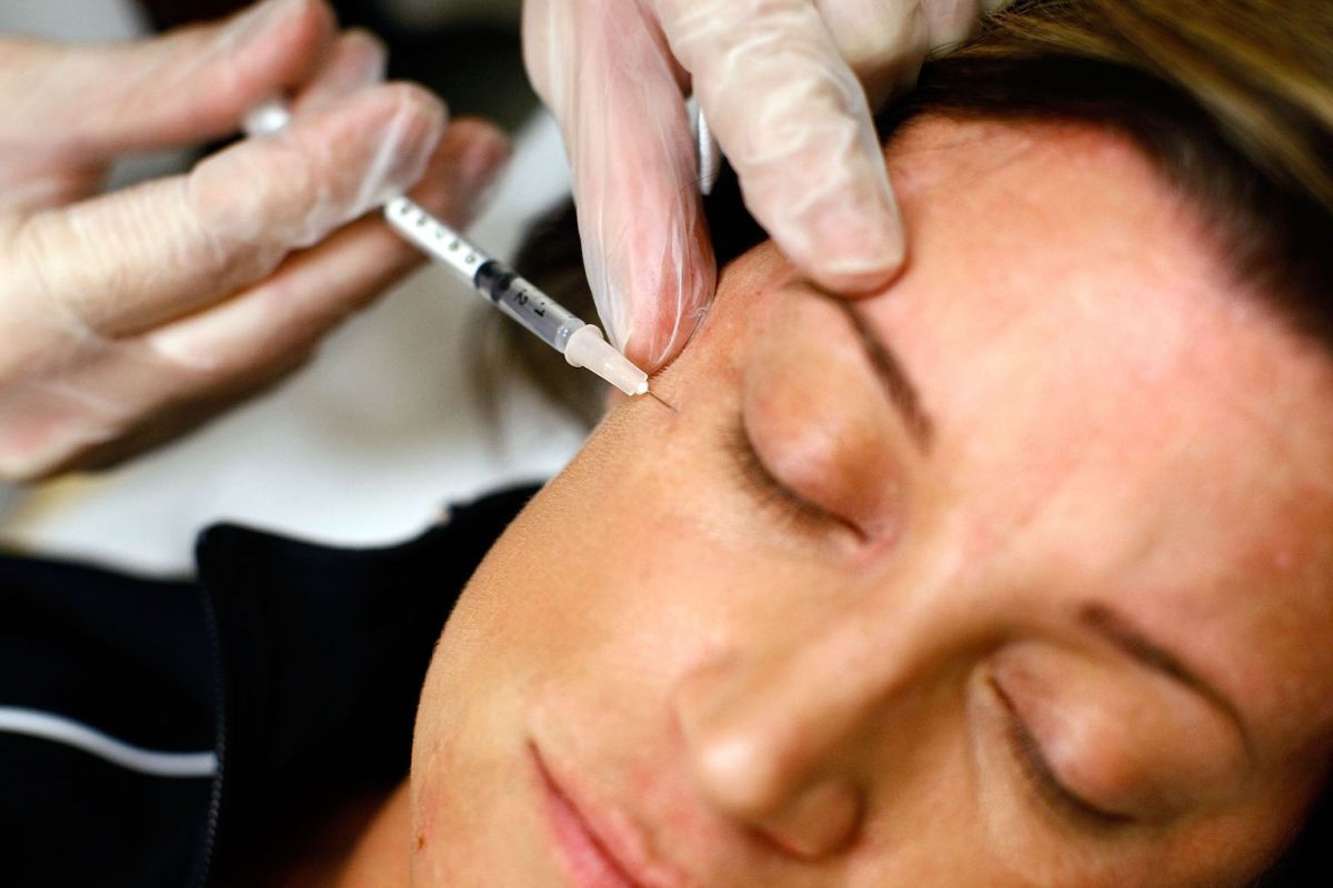 El estudio descubrió que el botox obstaculizaba la "hipótesis de retroalimentación facial". / Foto: Getty Images 